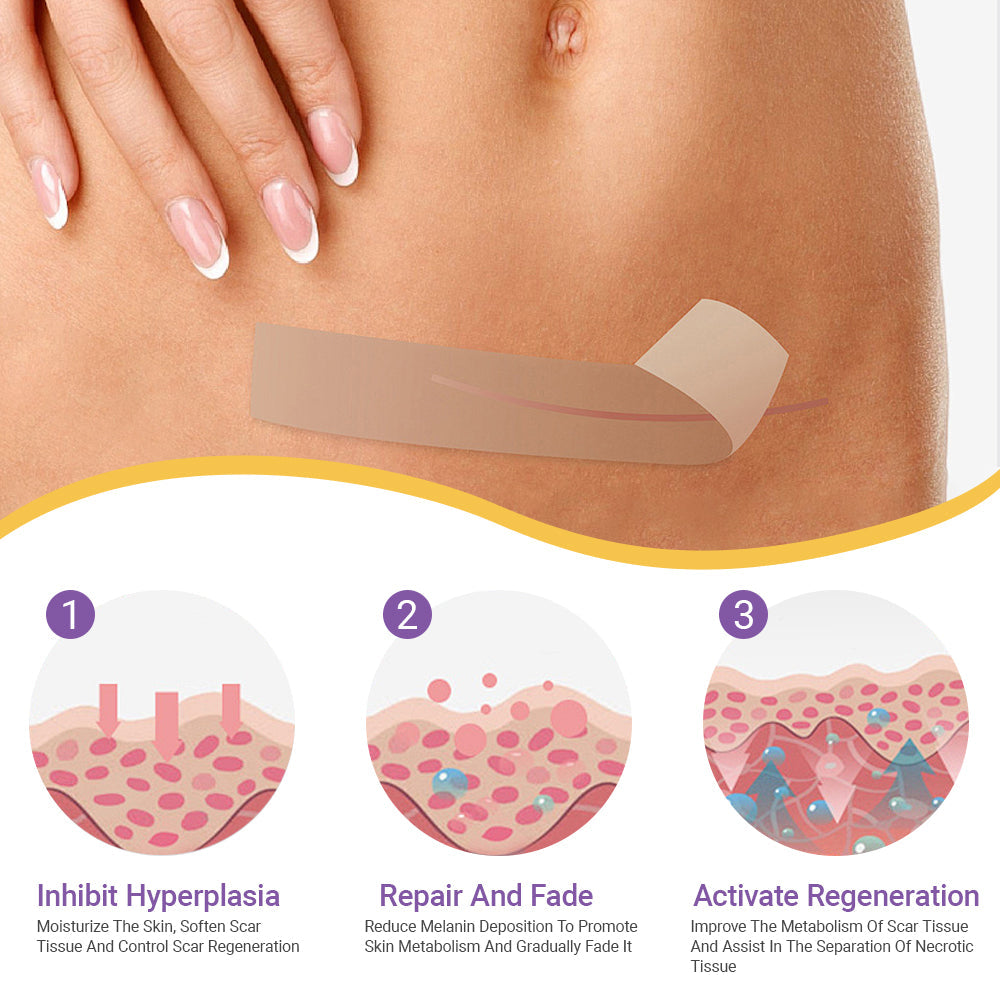 The Scar Cream Lie: Why 99% of Treatments Can't Work (And the One That Finally Does)