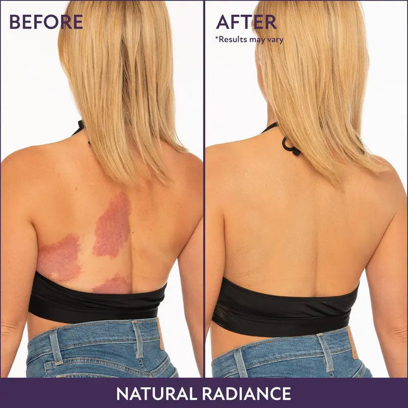 Body Coverage Perfector – Waterproof Leg & Body Makeup - Tattoo Cover Up Makeup