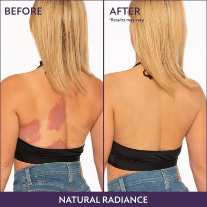 Body Coverage Perfector – Waterproof Leg & Body Makeup - Tattoo Cover Up Makeup