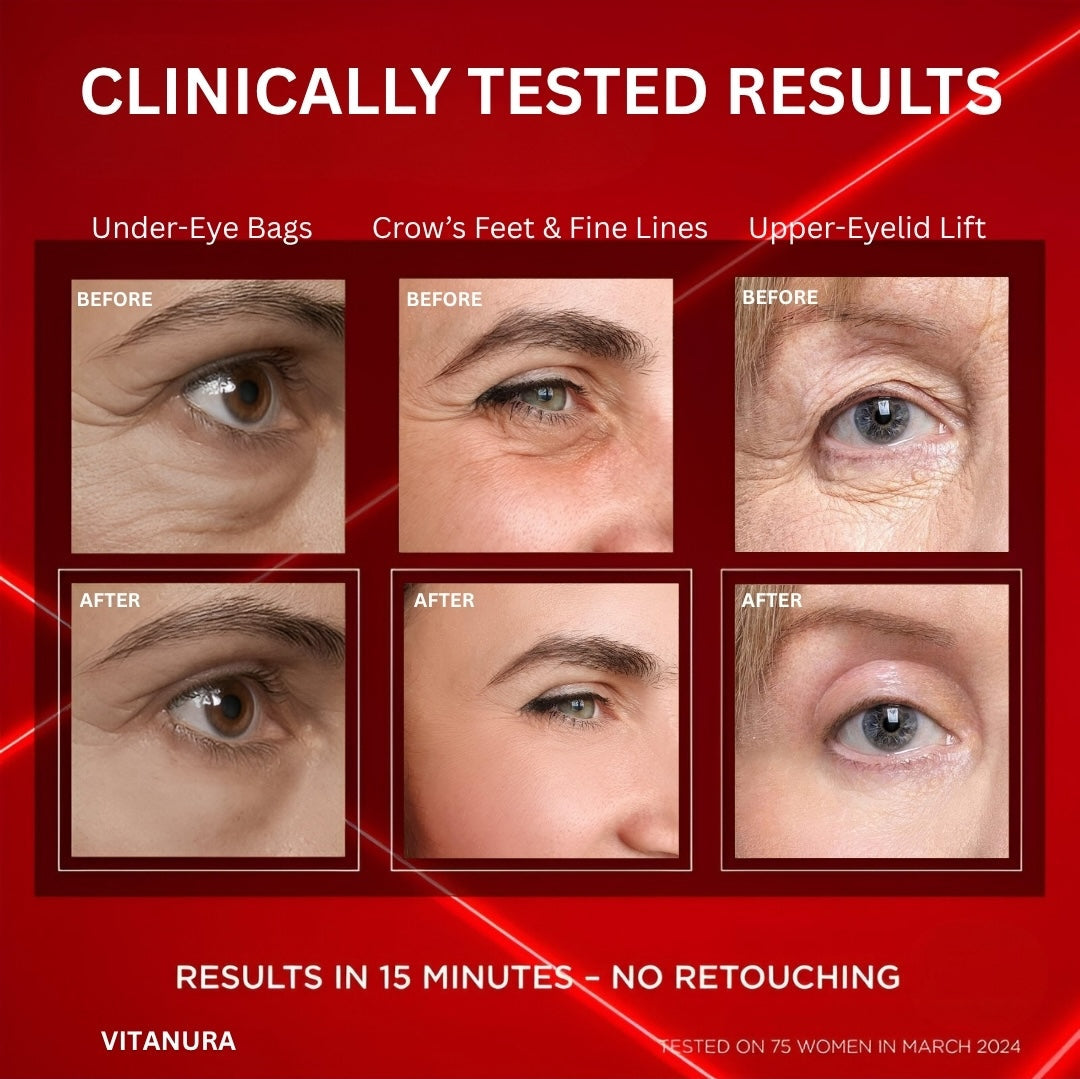 EYE BAG INSTANT ERASER – New Formula, Ultimate Lift & Smooth Finish ✨