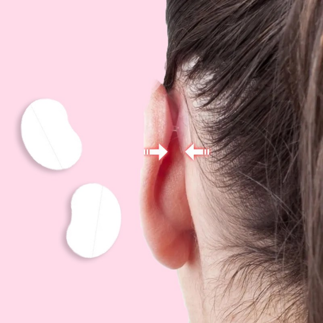 EarAlign™ - Comfortable ear shaping plasters