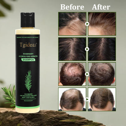 Tgideas Organic Rosemary Hair Growth Shampoo