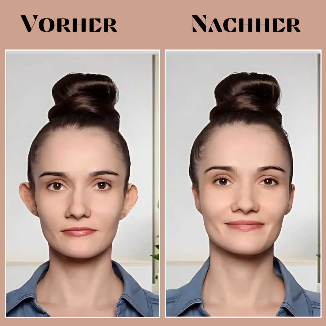 EarAlign™ - Comfortable ear shaping plasters