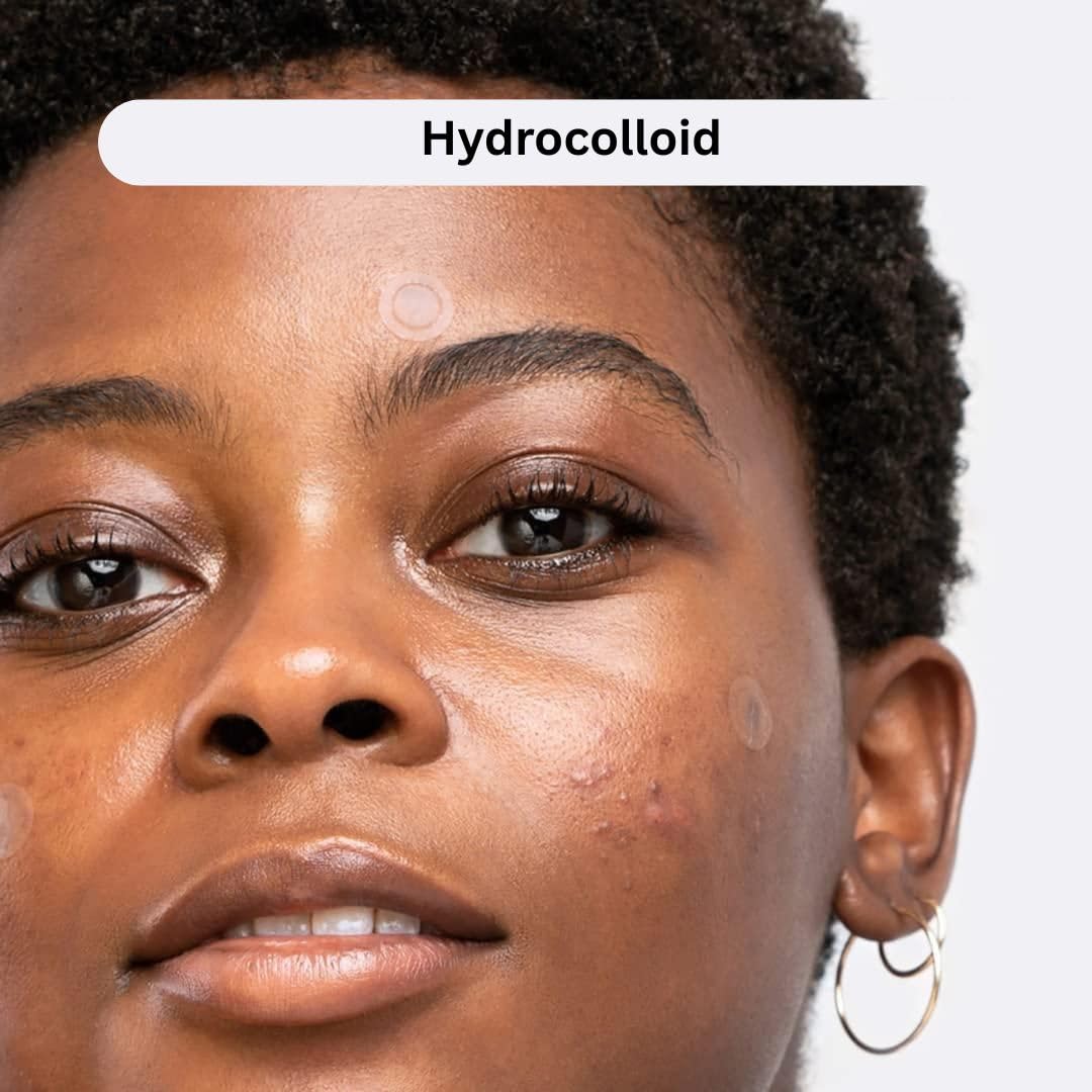 Pimple Patches for Acne and Wrinkle – Hydrocolloid Dots for Face, Smile Line Lift, Vitamin C, Salicylic Acid, Tea Tree, Blackhead and Blemish Spot Patch – Skincare Must - face mask.