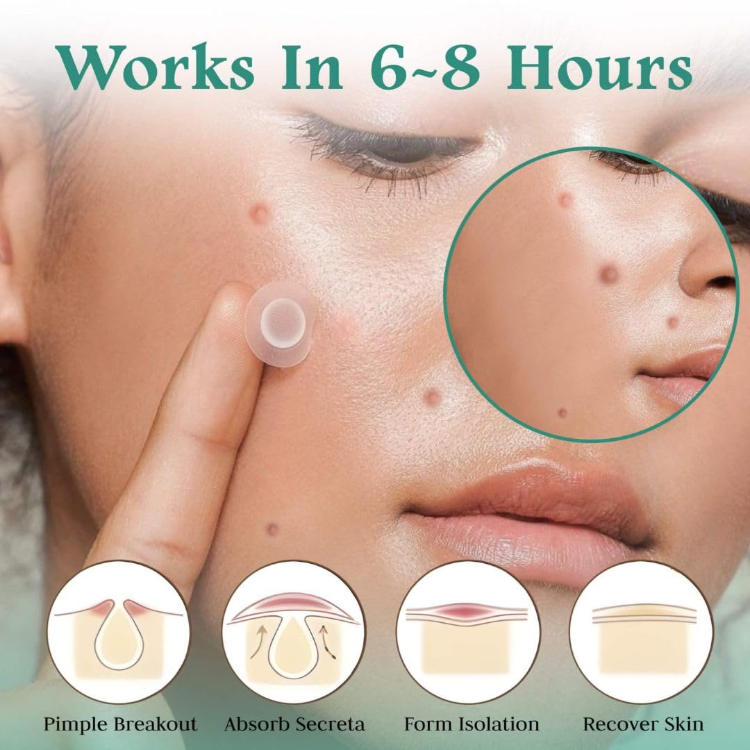 Pimple Patches for Acne and Wrinkle – Hydrocolloid Dots for Face, Smile Line Lift, Vitamin C, Salicylic Acid, Tea Tree, Blackhead and Blemish Spot Patch – Skincare Must - face mask.