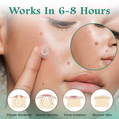 Pimple Patches for Acne and Wrinkle – Hydrocolloid Dots for Face, Smile Line Lift, Vitamin C, Salicylic Acid, Tea Tree, Blackhead and Blemish Spot Patch – Skincare Must - face mask.
