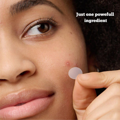 Pimple Patches for Acne and Wrinkle – Hydrocolloid Dots for Face, Smile Line Lift, Vitamin C, Salicylic Acid, Tea Tree, Blackhead and Blemish Spot Patch – Skincare Must - face mask.