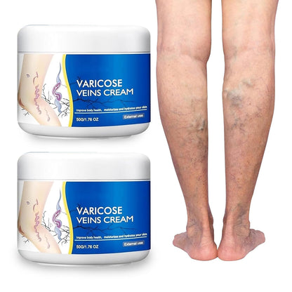 Varicose Veins Treatment for Legs, Spider Varicose Veins Relief Cream, Skin Cream for Legs 50g/1