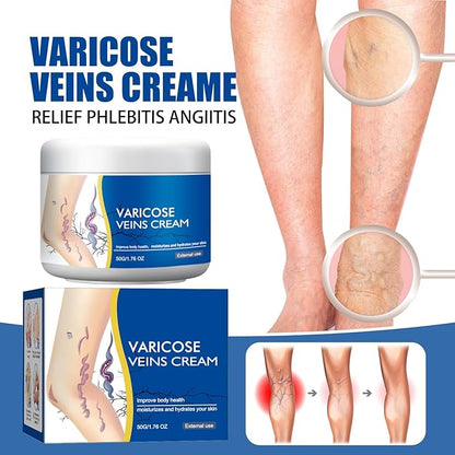 Varicose Veins Treatment for Legs, Spider Varicose Veins Relief Cream, Skin Cream for Legs 50g/1