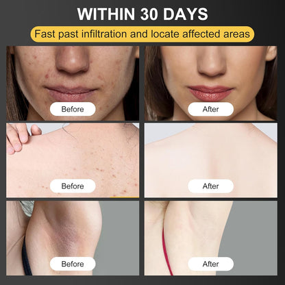 BEE VENOMSKIN TREATMENT CREAM