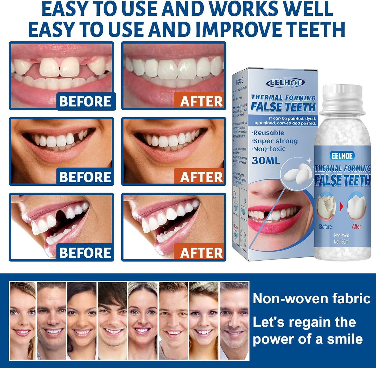 Temporary Tooth Repair: Perfect Solution for Gaps and Missing Teeth!✨