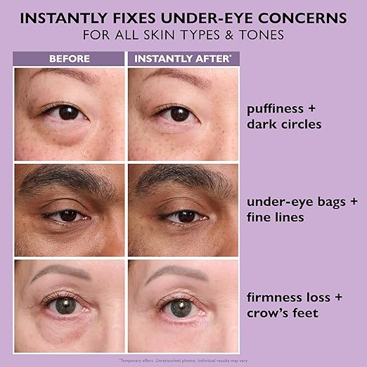 ✨Limited-time offer: 50% off🔥Instant  Eye Temporary Eye Tightener Easy-Wear Formula