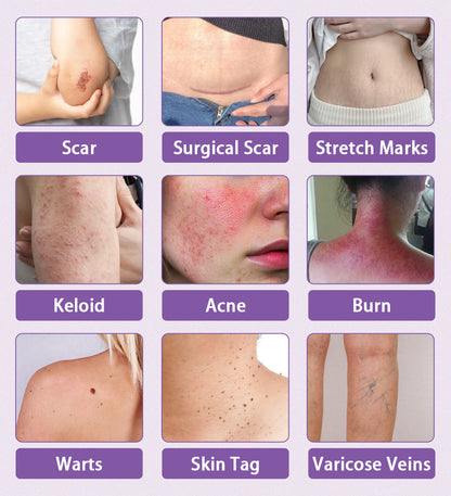 The Scar Cream Lie: Why 99% of Treatments Can't Work (And the One That Finally Does)