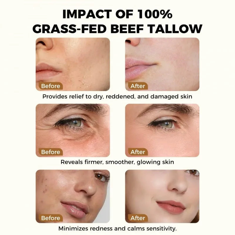 🔥Hot Sale 49% OFF -Whipped Tallow Honey Balm