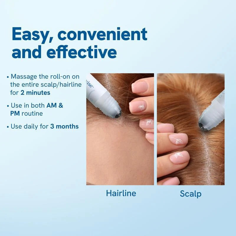 🌱 Hair Growth Roll-On Serum – Restore Confidence, Regrow Hair